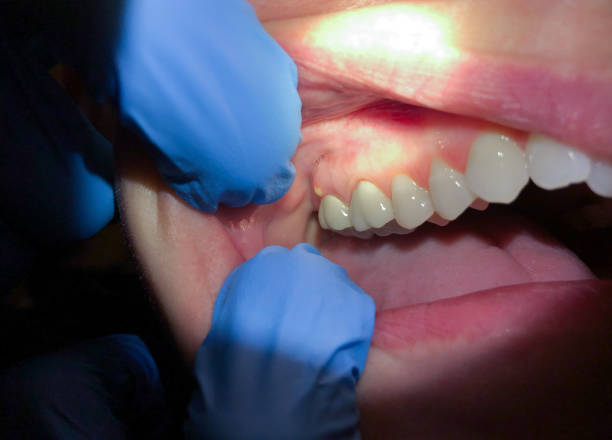 Dentist for Dental Trauma in NJ