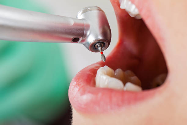 Best Broken Tooth Emergency  in Florham Park, NJ